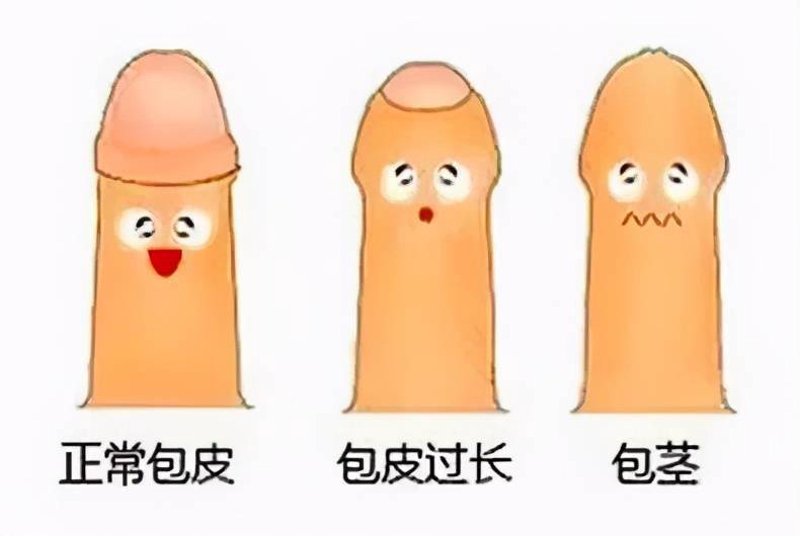 前列腺病是什么原因引起的？这是一个困扰着许多男性朋友的难题。今天，我们就来揭开这个谜团。